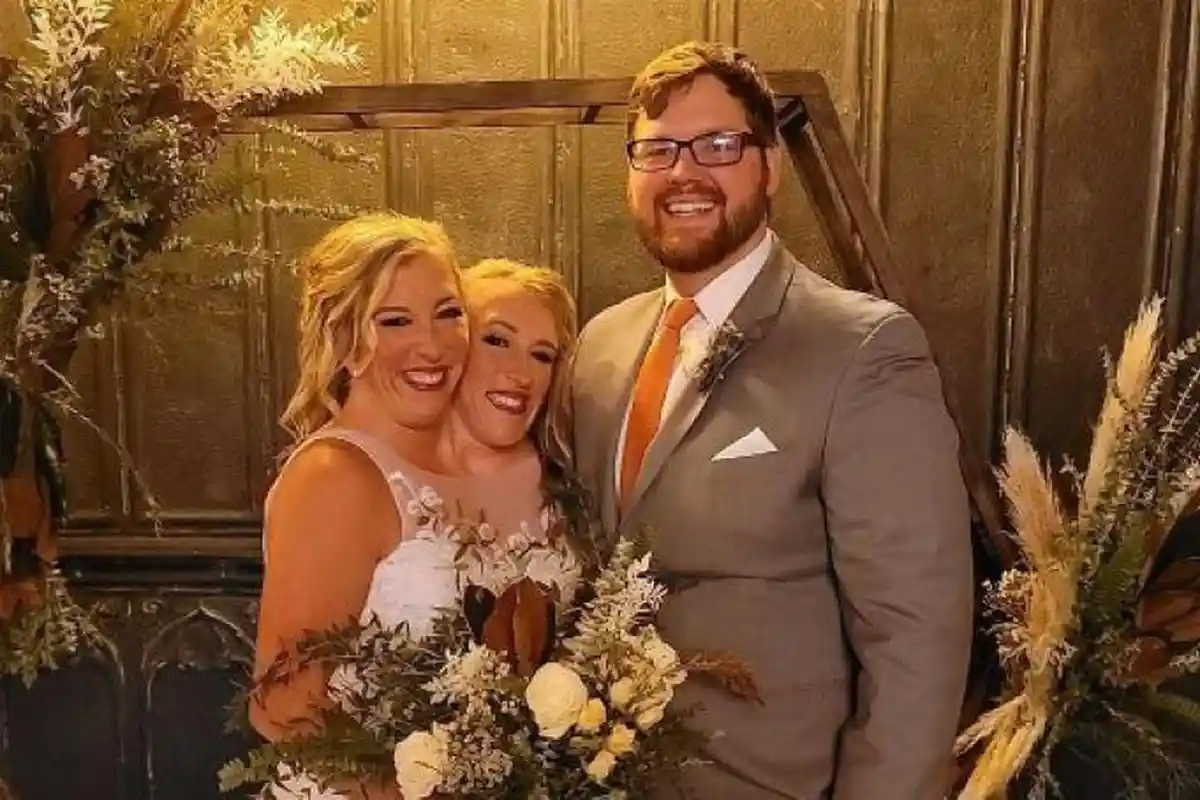 Viral Kisah Kembar Siam Abby Hensel Menikah dengan Veteran Josh Bowling, Dirahasiakan 2 Tahun