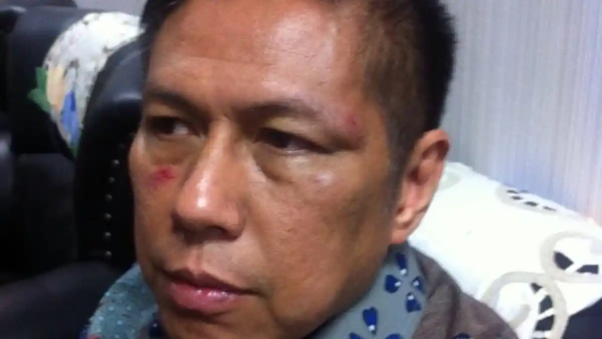 MKD Diminta Putuskan Secara Final Kasus Pemukulan di DPR‎