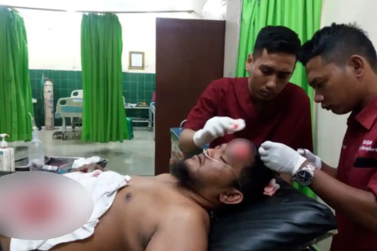 Fakta Penyerangan Seniman Mural di Underpass Unila, Wali Kota Bandar Lampung Sampai Berang