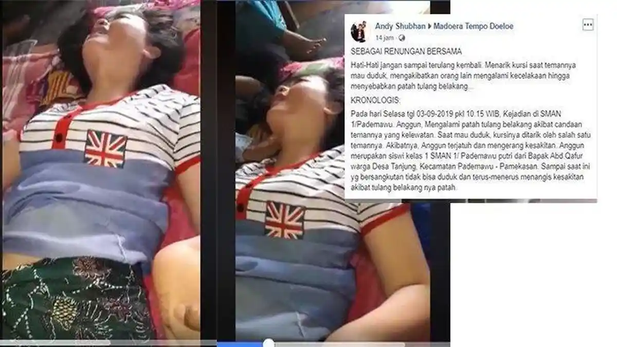 Stop Bercanda Menarik Kursi saat Temannya Mau Duduk, Siswi Cantik Ini Cedera Patah Tulang Belakang
