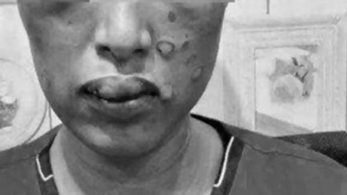 RN Dihajar Suami, Kemaluan Digesek Cobek Ulekan