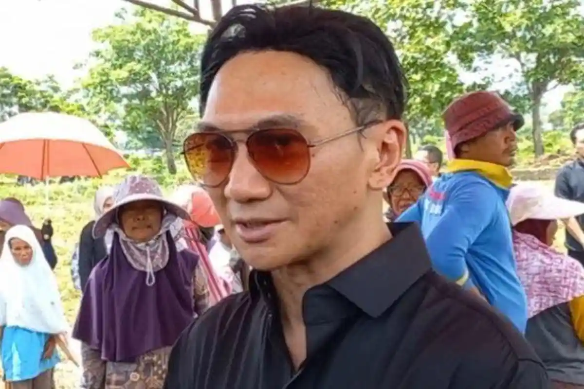 Anji Manji Tak Lagi Botak Plontos, Kini Pakai Rambut Palsu