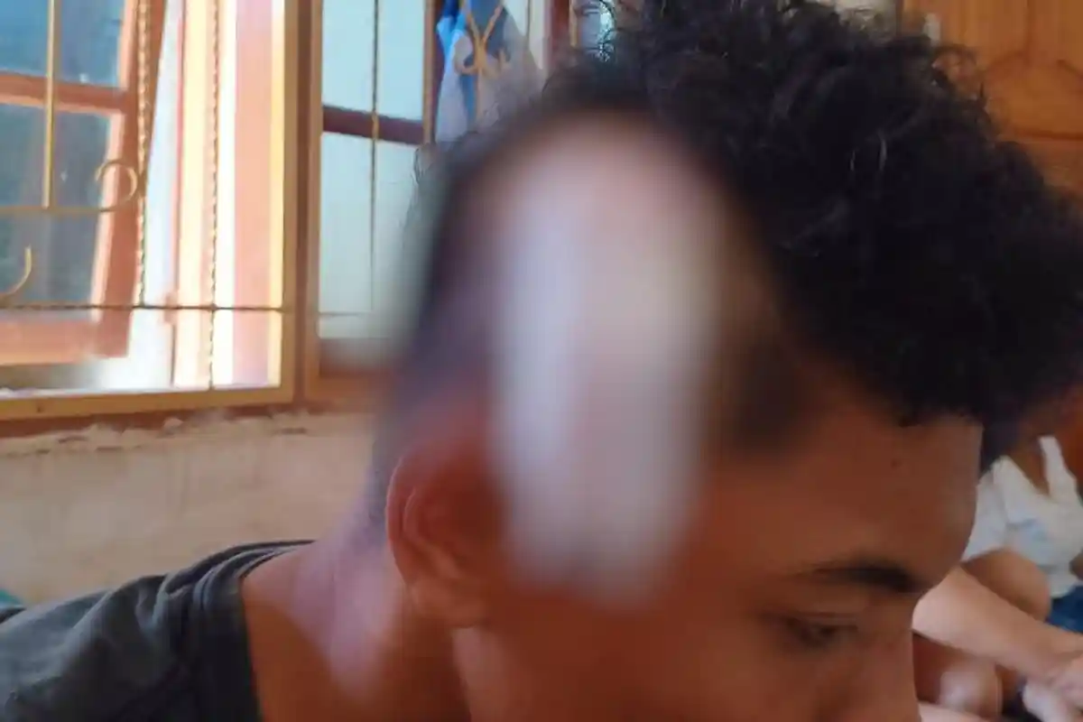 Pelajar di Labuan Bajo Jadi Korban Pembacokan Kelompok Pemuda