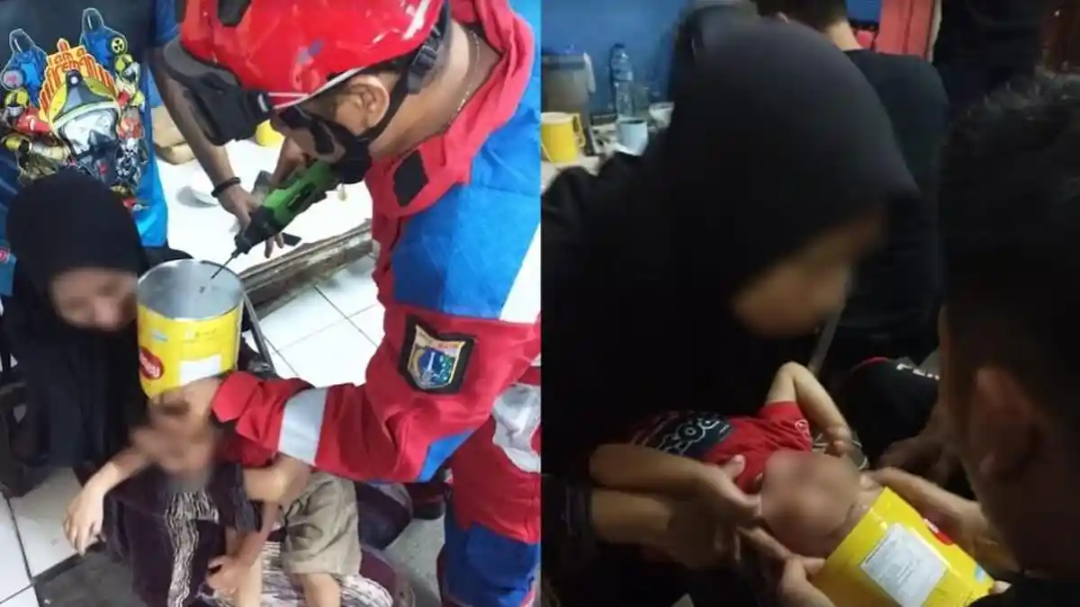 Kaleng Biskuit Terjebak di Kepala Bocah Ini saat Bermain, Sampai Harus Panggil Petugas Damkar