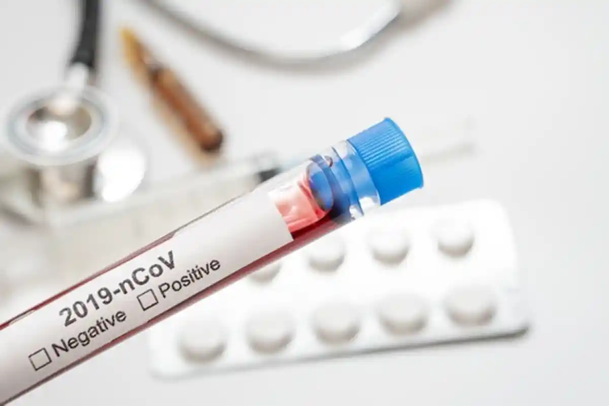 New Rules, Passengers who Entering Riau Islands Do not be Sick, Governor: Must Be Honest!