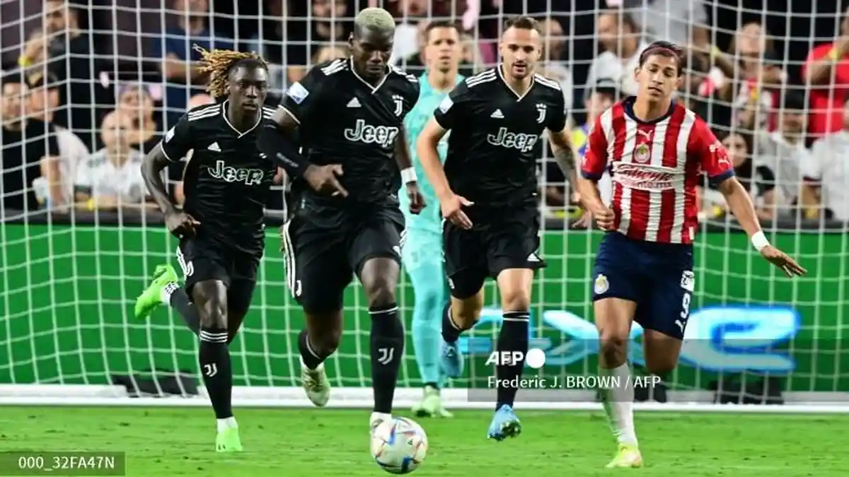 Keputusan Paul Pogba Perburuk Cederanya, Juventus dan Timnas Prancis Sama-sama Rugi