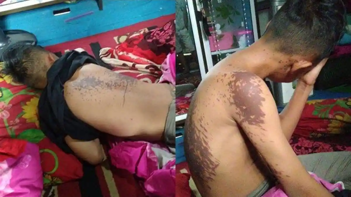 Pria Kesal Isi Hatinya Ditolak, si Pria Sirami Anak Janda Idamannya Pakai Air Keras saat Tertidur