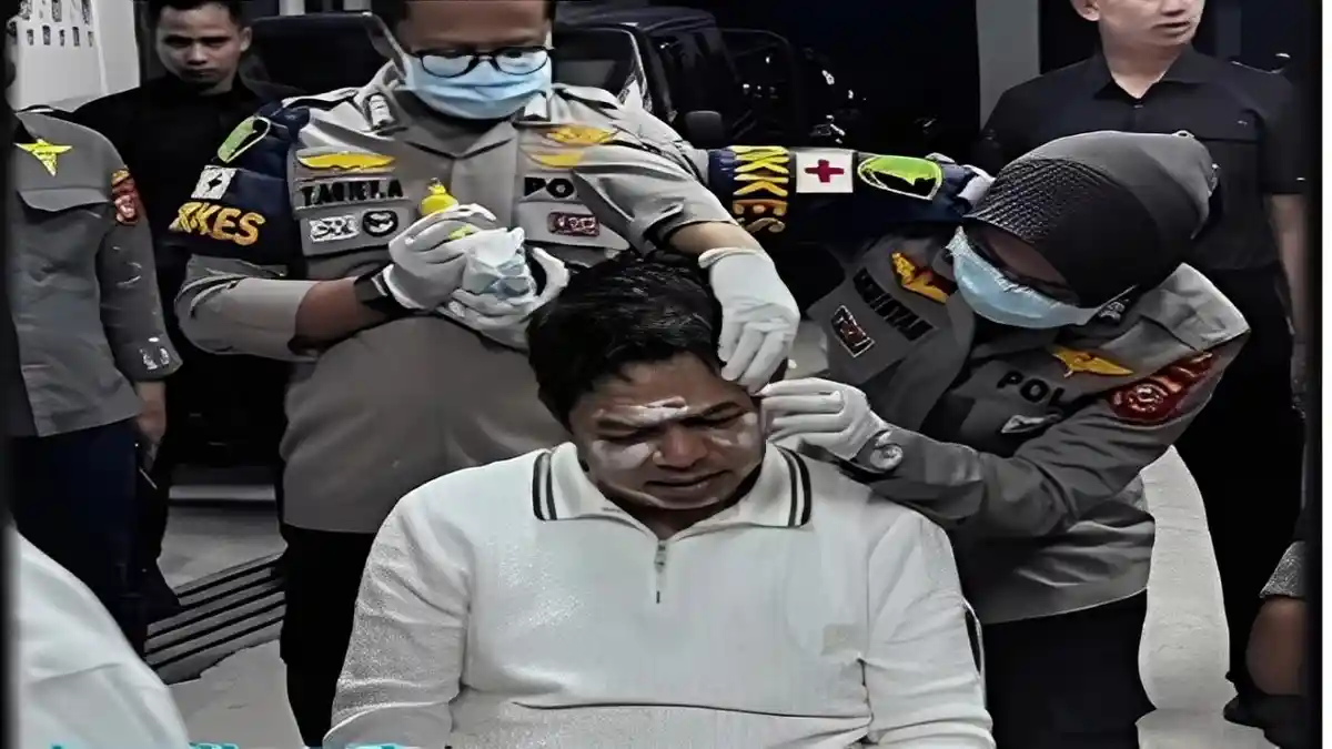 Kondisi Dedi Mulyadi setelah Dilempar Botol dan Dipukul Kayu saat Demo, Alami Luka di Kepala