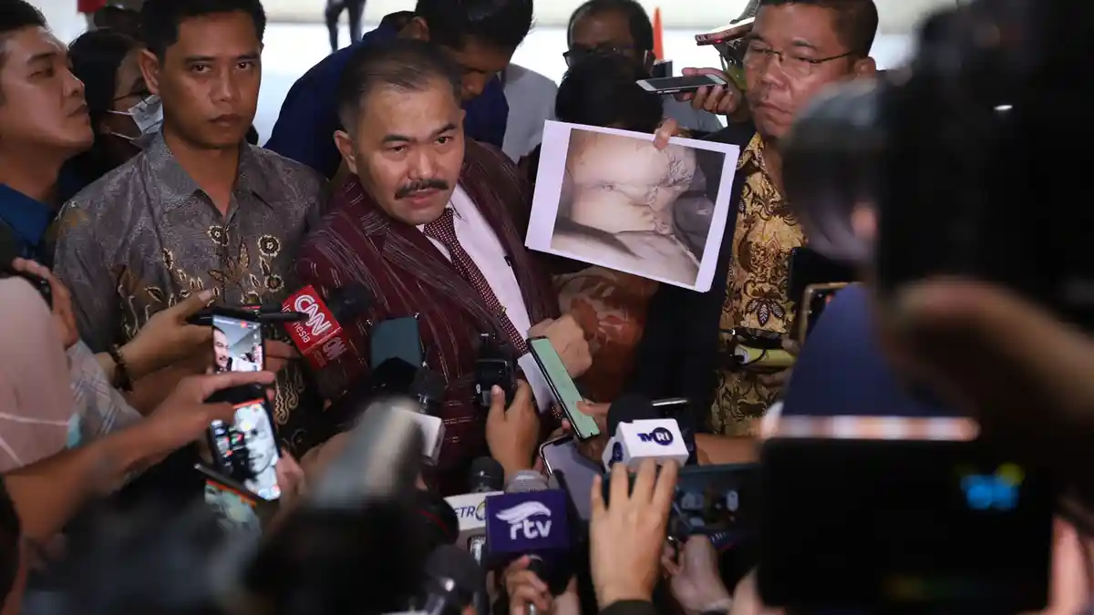 Hasil Autopsi Ulang Brigadir J Menurut Pengacara: Ada Lubang di Kepala yang Tembus ke Hidung