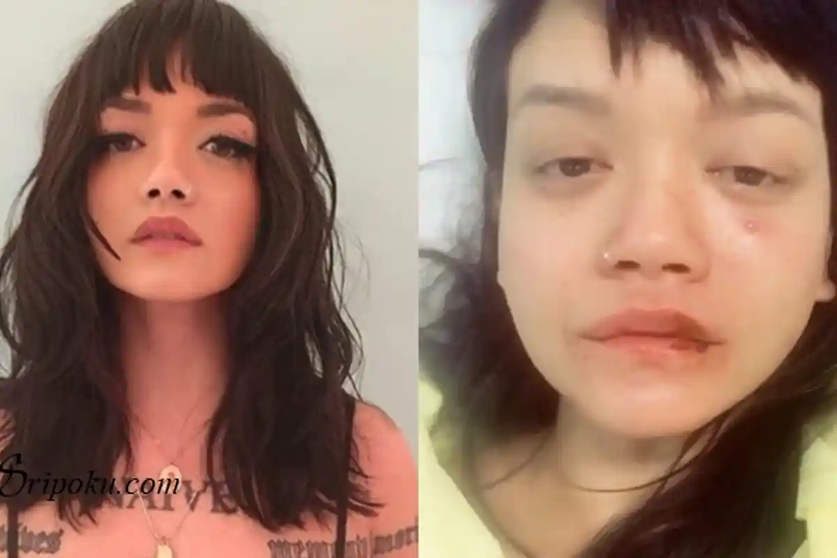 Jadi Korban Kekerasan Pacarnya, Kini Dylan Sada Kembali Beberkan Masa Kelam Hidupnya, Ternyata