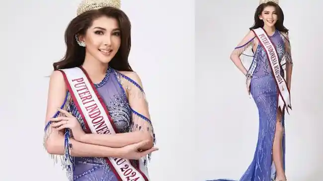 Profil Eks Finalis Puteri Indonesia yang Ditangkap usai Jadi Dokter Kecantikan Gadungan & Malpraktik