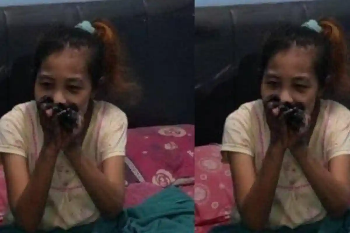 Kisah Pilu TKW Jember, Kaki dan Tangannya Menghitam karena Nekrosis setelah Operasi di Singapura