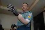 Tangan Bionic Buatan Undip