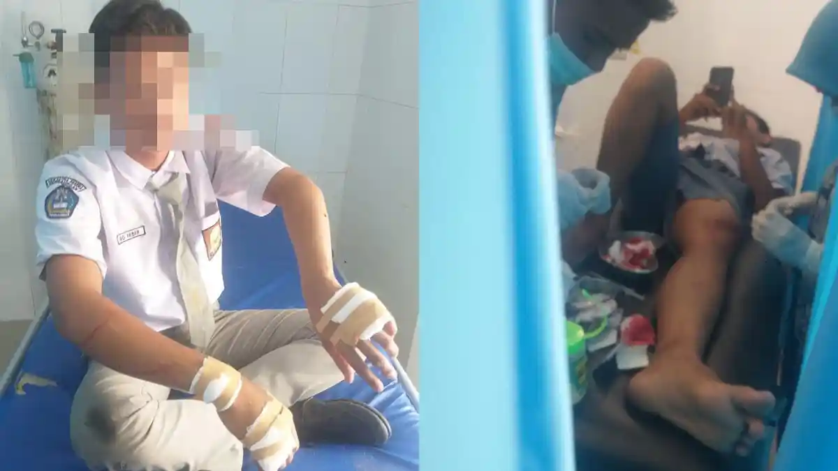 Kronologi Puluhan Pelajar Bawa Sajam dan Bacok Dua Siswa di Sergai, Warga Ketakutan