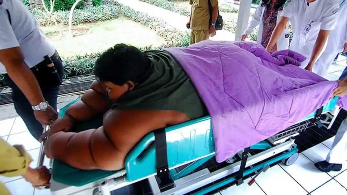 Media Luar Negeri Soroti secara Eksklusif Kehidupan Arya Permana, Bocah 11 Tahun dengan Bobot 190 kg