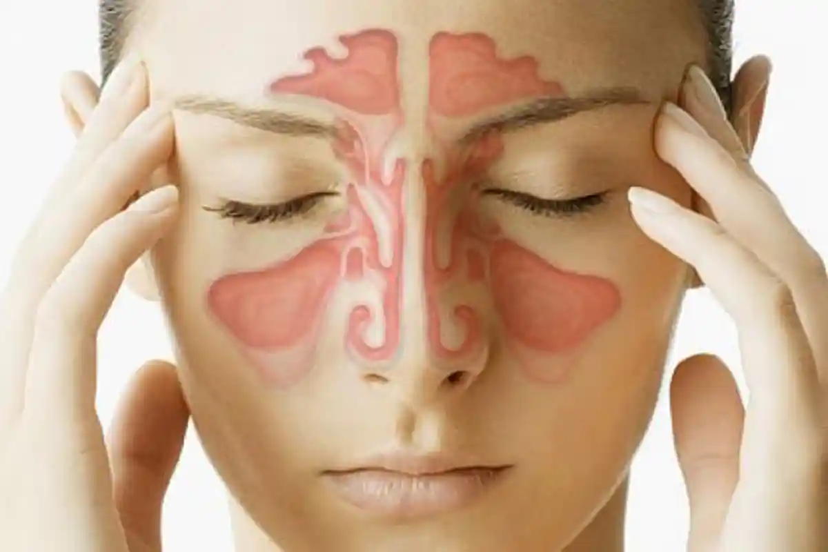 Cara Mengobati Sinusitis dengan Bahan Alami - Hirup Uap Bawang Merah, Cuka Apel, Jahe, Kunyit