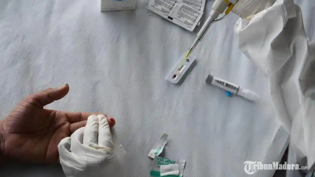 Ratusan Pedagang di Tiga Pasar di Bojonegoro Jalani Rapid Test, Ada Sejumlah Orang yang Reaktif