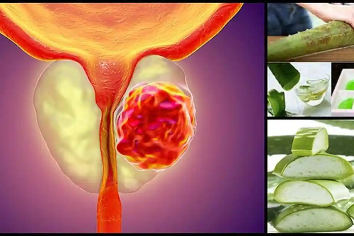 Cegah Kanker Prostat, Hindari Mengonsumsi Tiga Jenis Makanan Ini