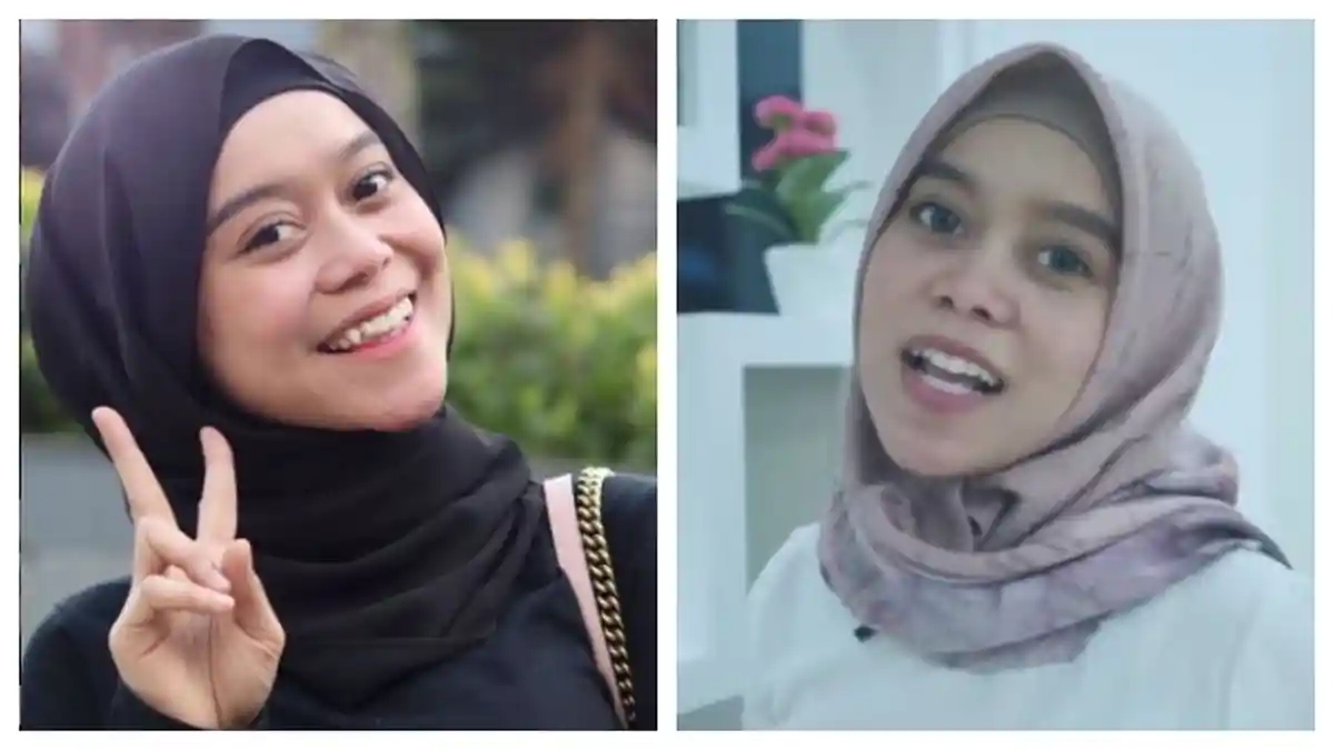 Hilangkan Gingsul, Lesti Kejora Dapat Dukungan dari Rizky Billar: Emang Itu yang Terbaik Buat Dedek