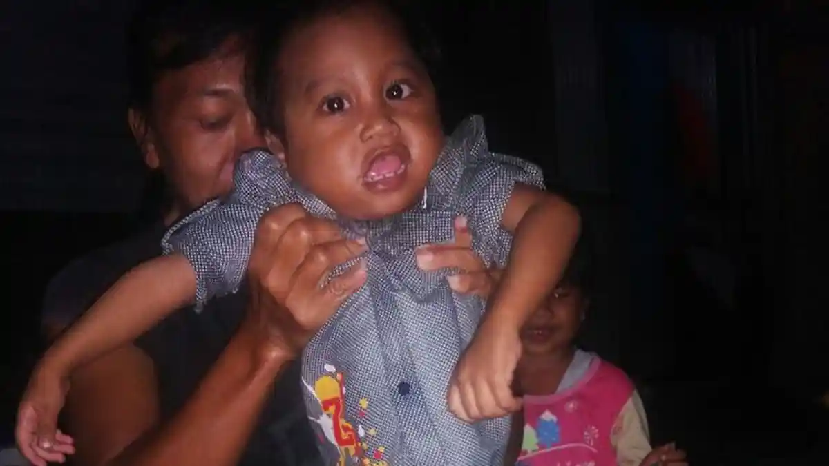 Bocah Lumpuh Otak Dibiarkan Tergolek di Rumah