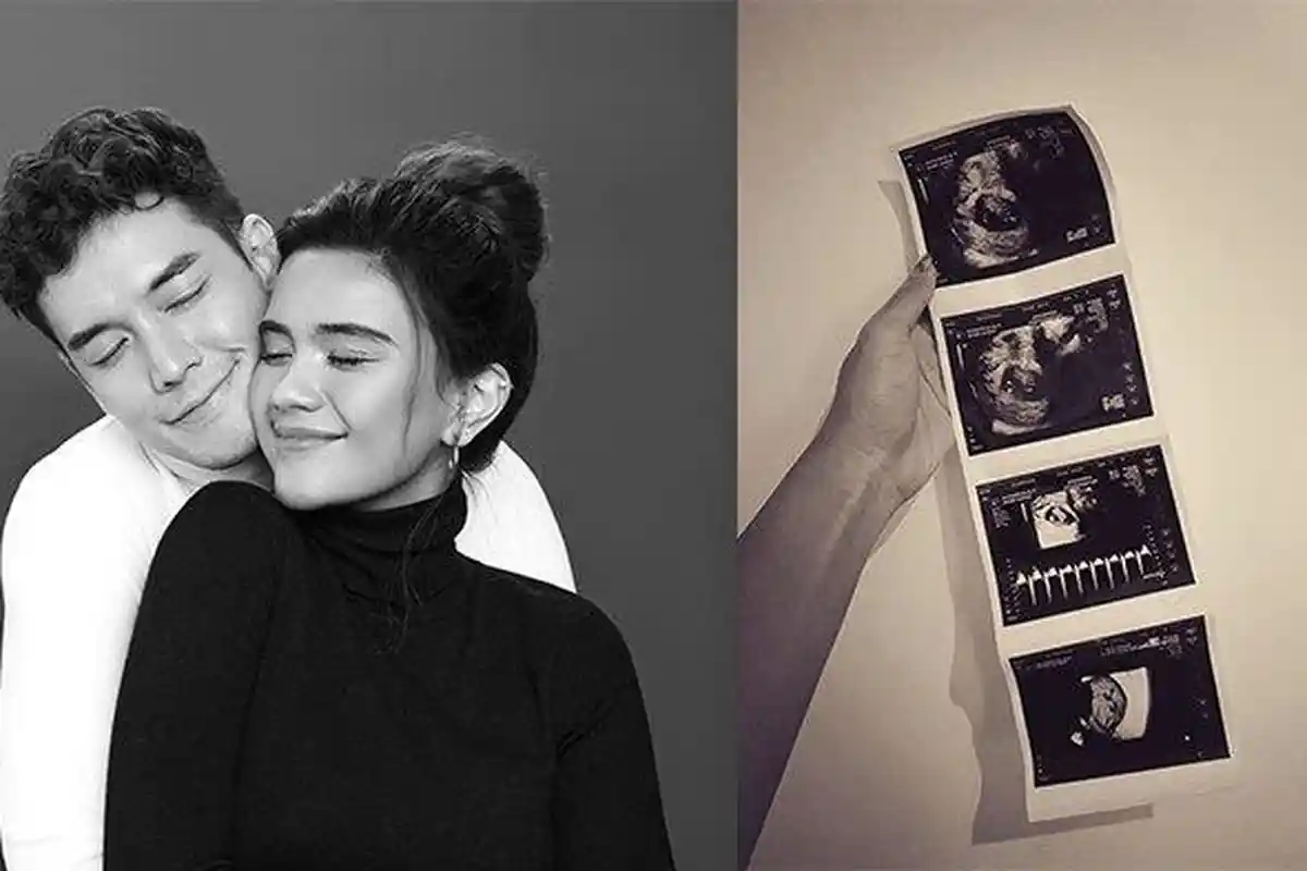 Hamil Anak Pertama, Audi Marissa Curhat Tak Bisa Main TikTok Lagi