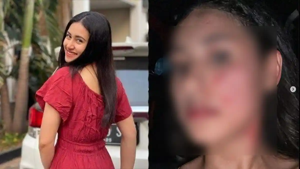 Selebgram Afifah Riyad Babak Belur Dianiaya Eks Pacar Suami, Bayinya Disumpahi Celaka Sama Pelaku