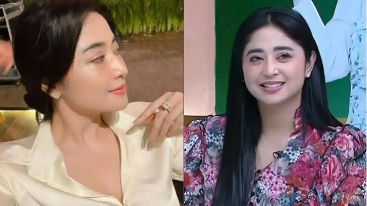 Transformasi Dewi Perssik dari Kecil hingga Pasca-jalani Tindakan Operasi di Wajah