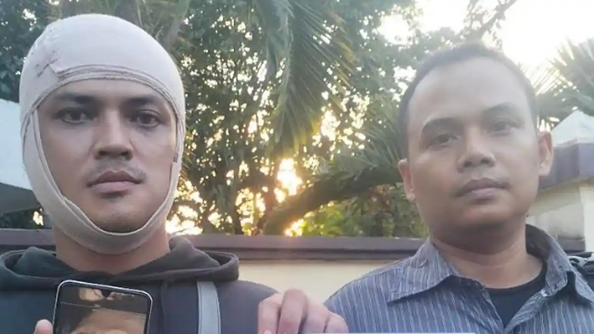 DJ Diduga Keroyok Pelayan Klub Malam di Surabaya, Emosi Pacar Didekati