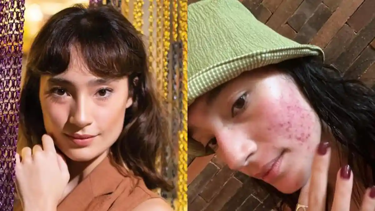 Profil dan Medsos Tatjana Saphira, Artis Kenamaan yang Pede Pamer Wajah ...