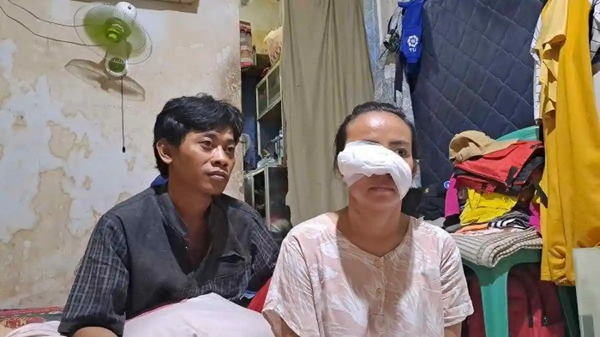 Istri Disayat Mantan Pacar Suami, Ancaman Sempat tak Digubris, Korban Dapat 28 Jaitan di Wajah