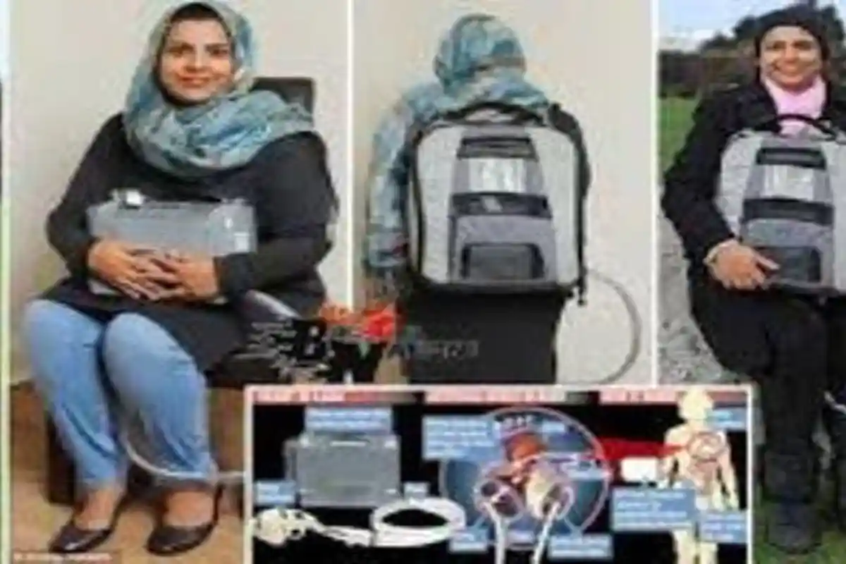 KISAH Wanita Hidup dengan Jantung di Ransel, Tetap Hidup dengan Jantung di Luar Tubuh