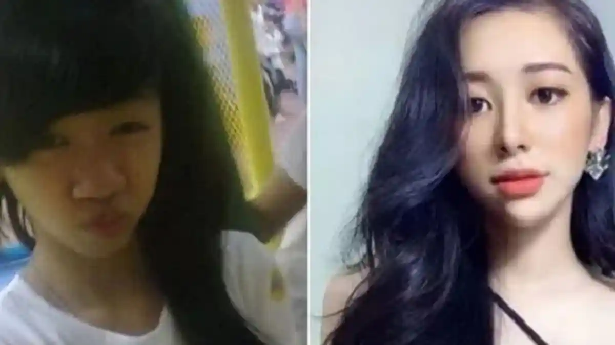 Malu Sang Pacar Tak Mengakuinya saat Hadir di Pesta Teman, Gadis Ini Operasi Plastik Setelah Putus