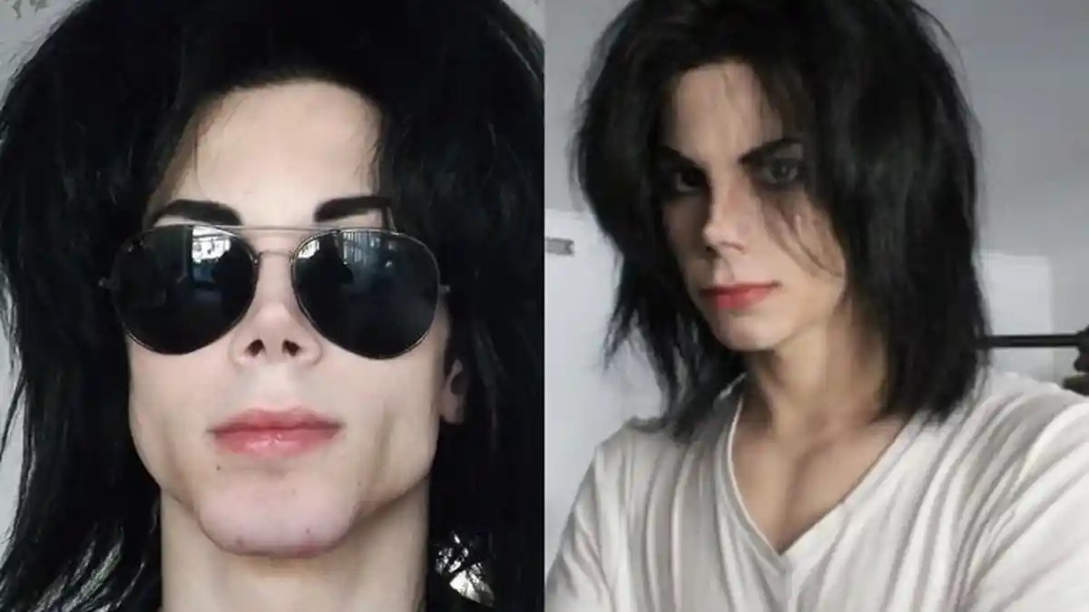 Ibunya Sampai Tak Mengenali, Sosok Ini 15 Tahun Operasi Sampai Mirip Michael Jackson