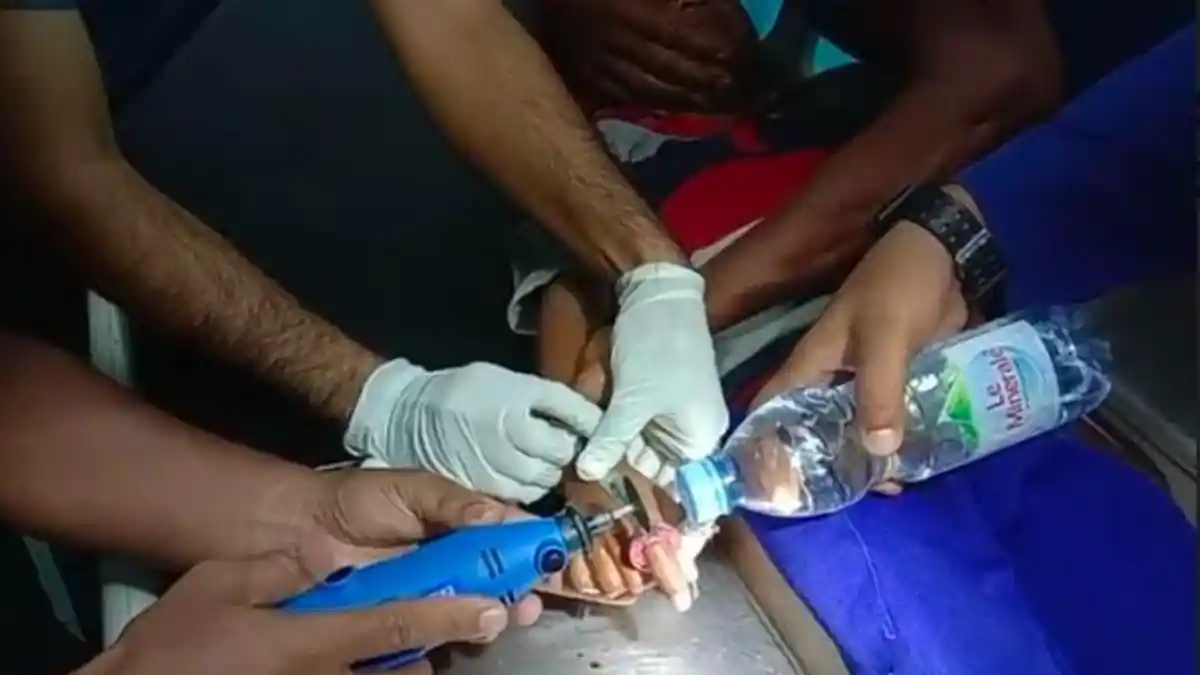 Damkar Asahan Bantu Lepaskan Ring dari Jari Seorang Bocah, Tangan Sempat Luka