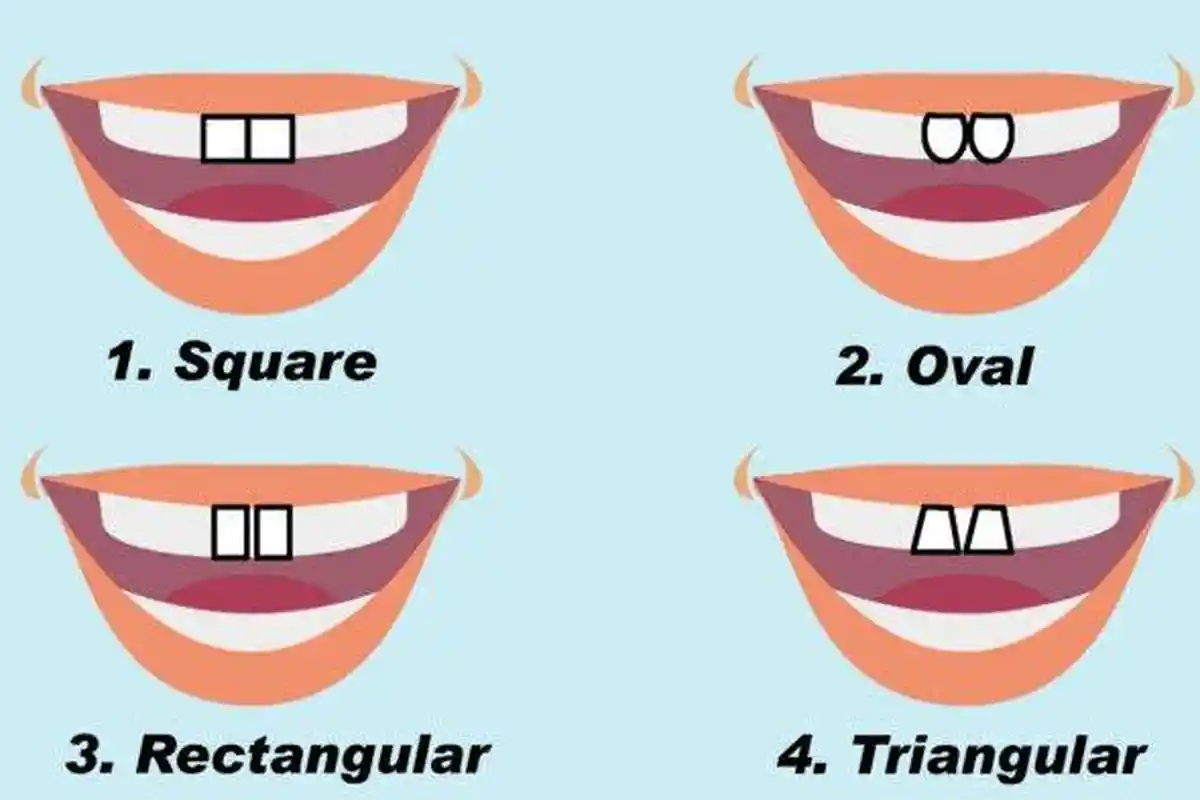 Tes Kepribadian: Oval, Persegi atau Persegi Panjang? Bentuk Gigi Depanmu Bisa Ungkap Karaktermu