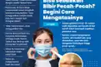 INFOGRAFIS Tips Atasi Bibir Kering karena Pakai Masker
