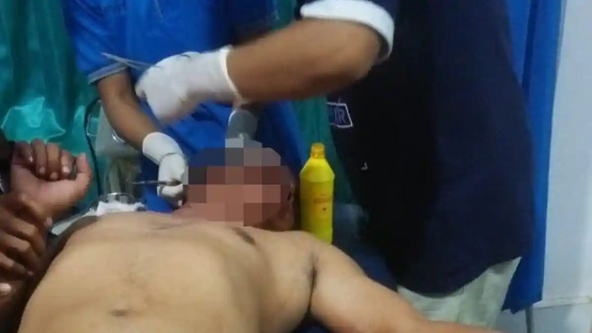 Tersangka Penganiayaan Terhadap Seorang Pria di Bolsel Diduga Lebih dari Satu Orang