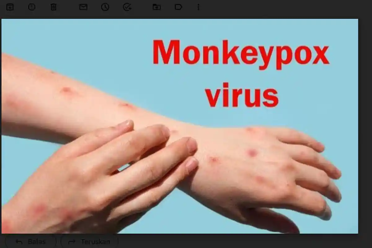 Awas! Cacar Monyet Muncul Lagi di Indonesia