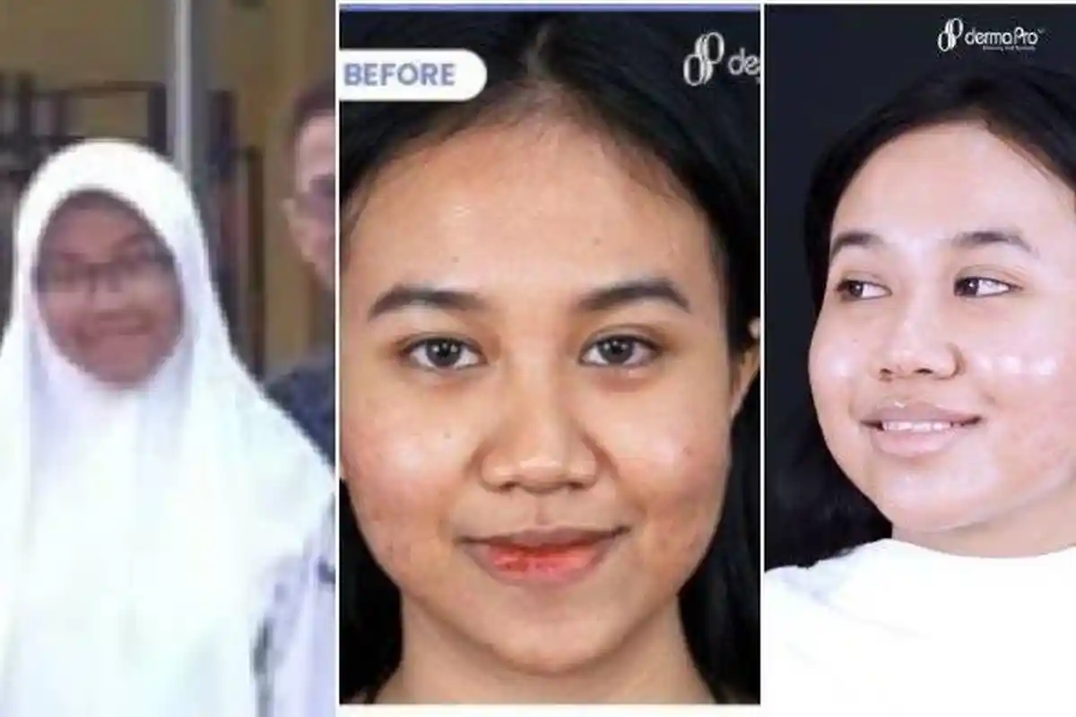 Intip Transformasi Mayang yang Kini Makin Terkenal, Rogoh Kocek hingga Rp 80 Juta untuk Perawatan