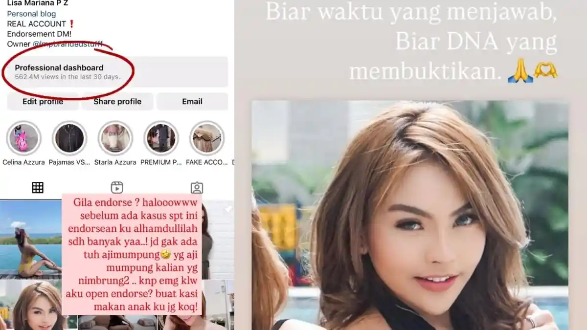 Kasusnya dengan Ridwan Kamil Viral, Dashboard Instagram Lisa Dikunjungi Lebih dari Setengah Miliar