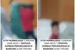 Kondisi Bocah 8 Tahun Jadi Korban Bullying di Bandung, Alami Trauma