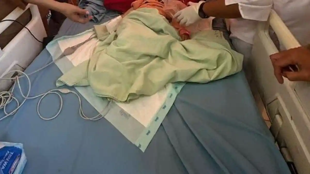 Cacing Sebesar Lidi Keluar dari Mulut dan Hidung Balita Kakak Beradik di Bengkulu, Begini Kondisinya