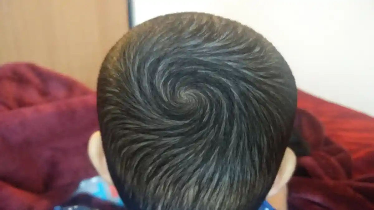 Fakta Jumlah Pusar Rambut atau Unyeng-unyeng yang Perlu Kamu Tahu