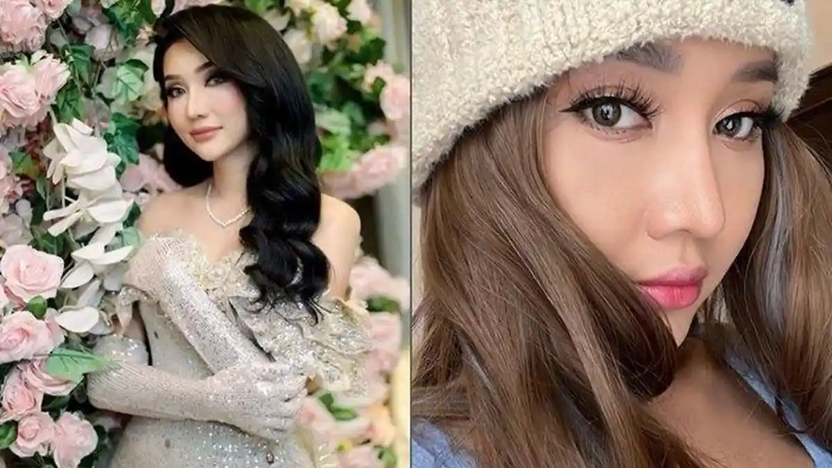 Lucinta Ingin Operasi Plastik Lagi Demi Mirip Artis Korea