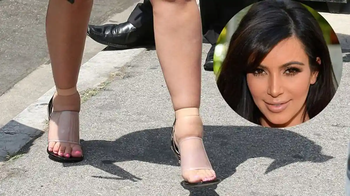 Tertangkap Kamera! 7 Artis Hollywood Ini Punya Kaki yang Nggak Semulus Wajahnya