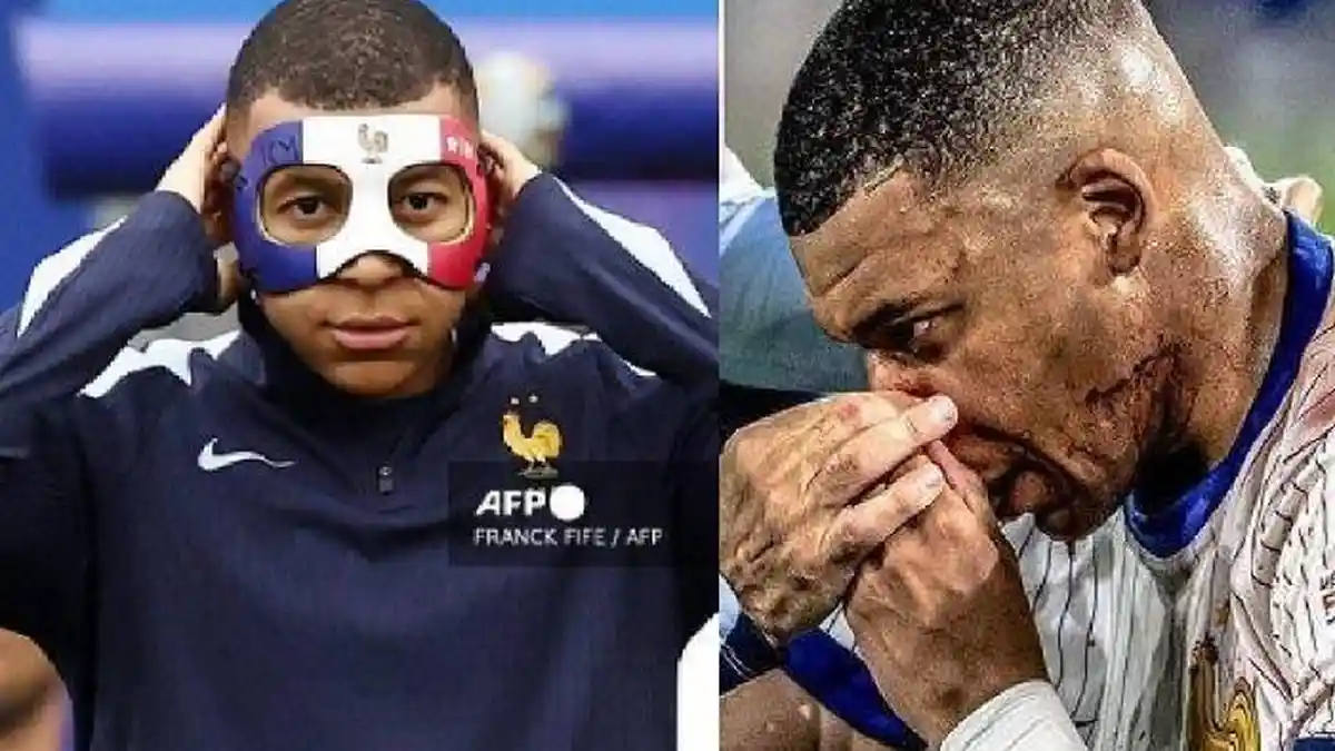 Fakta Prancis vs Polandia Euro 2024 Performa Mbappe Rumit Usai Pakai Topeng, Pelatih: Perlu Terbiasa
