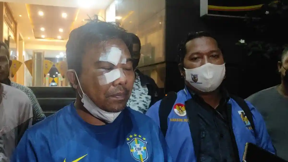 Dikeroyok Orang, Ketua KNPI Yakin Jadi Target Pembunuhan Berencana