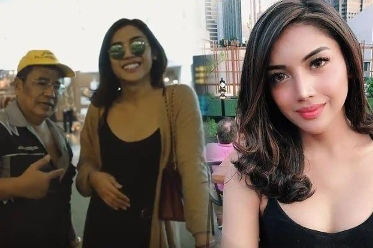 Buka-bukaannya Millendaru soal Implan Payudaranya Agar Terlihat Lebih Cantik dan Seperti Wanita