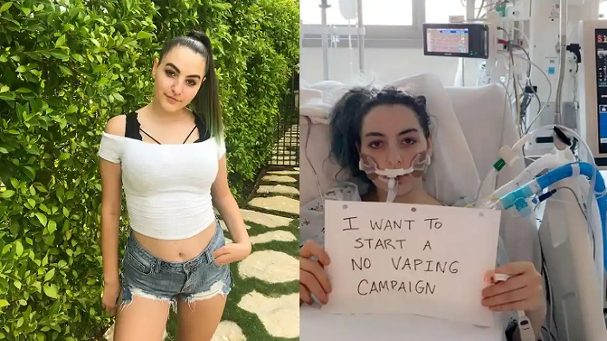 Peringatan Kerasnya di Instagram Viral, Nasib Gadis 18 Tahun Ini Berubah Total Karena Vaping