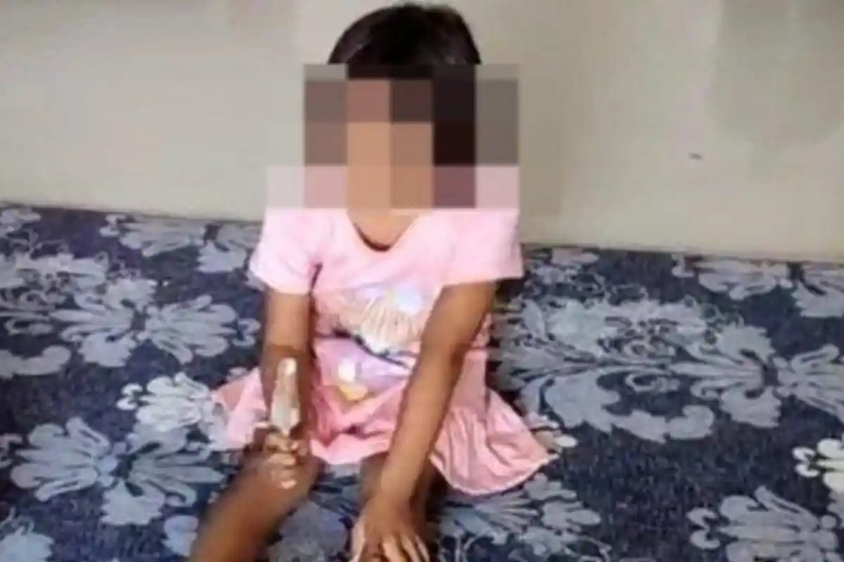 Bocah SD di Gresik Alami Buta Permanen, Mata Kanan Dicolok Kakak Kelas dengan Tusuk Bakso